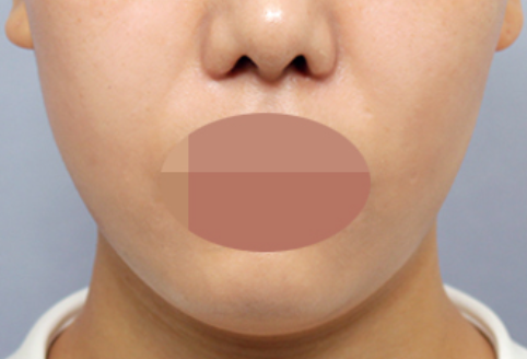 191510_8a0a0b843e.png