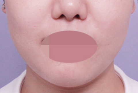 191518_a38470f751.png