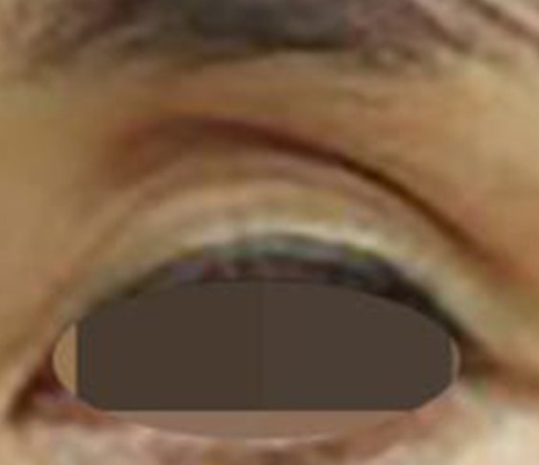 181851_46a82030fa.png